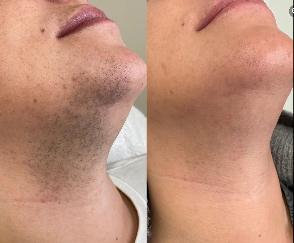 Cyperus Rotundus Skin Serum .